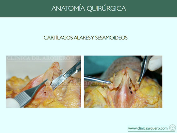 anatomia_quirurgica8