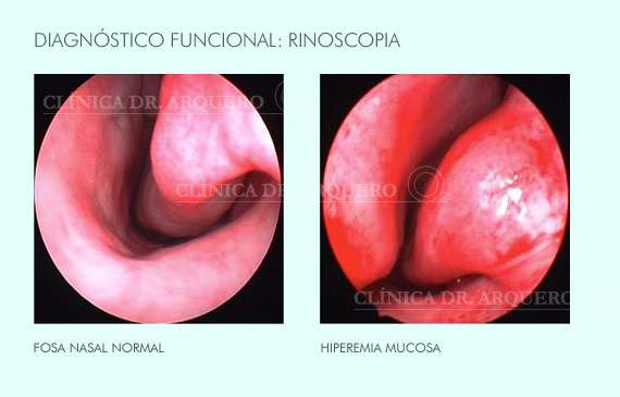 diagnostico_rinoscopia1