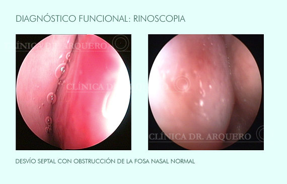 diagnostico_rinoscopia2